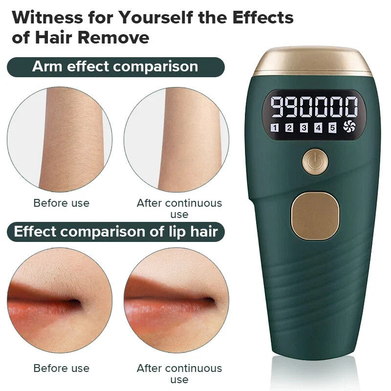 TAVICE IPL Hair Removal Device for Women and Men, 990,000 Flashes, At-Home Intense Pulsed Light Hair Remover for Face, Arms, Legs, Underarms, Bikini Line and Body